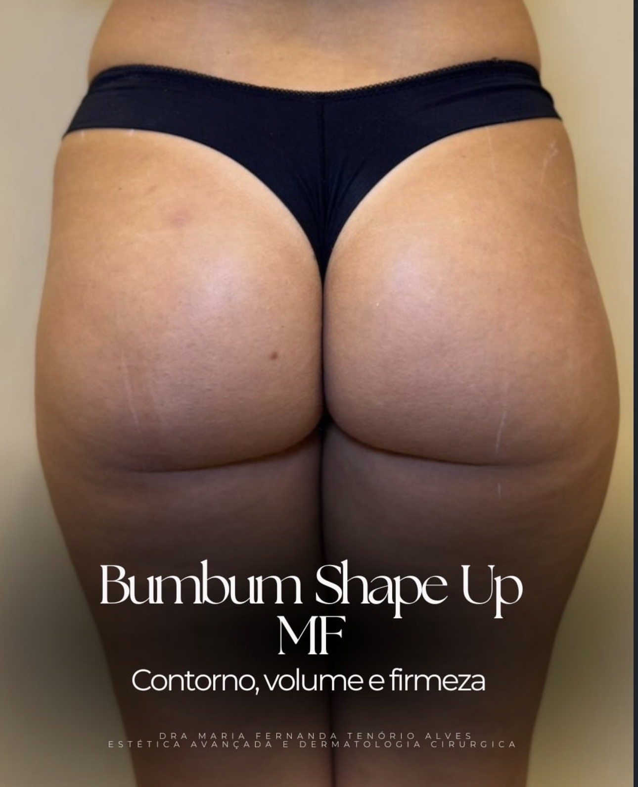 Contorno corporal com volume e firmeza definidos